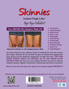 Skinnies Thigh Lift